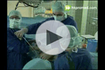 腹腔鏡輔助下陰式子宮切除術手術視頻